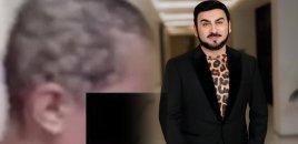 Tarix Əliyev o qadın üçün aidiyyatı qurumlara səsləndi