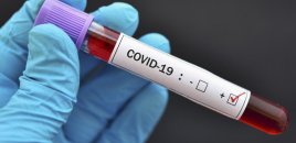 Növbəti koronavirus pandemiyasına yol aça biləcək virus aşkarlanıb