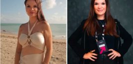 Sosial media fenomeni plastik əməliyyatdan sonra vəfat etdi - FOTOLAR
