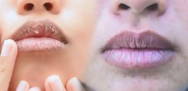Dodaqlarınızın rəngi nə deyir? – Bədəninizdən gələn səssiz siqnallar