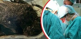 14 yaşlı qız qarın ağrısı ilə həkimə müraciət etdi - Mədəsindən çıxanlar həkimləri şoka saldı