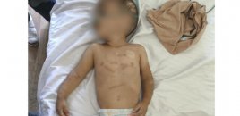 Valideynlərinin zorakılığa məruz qoyduğu azyaşlılar körpələr evinə yerləşdiriləcək - RƏSMİ
