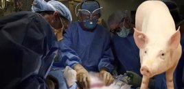 Dünyada ilk dəfə donuzdan insana ağciyər transplantasiyası həyata keçirilib