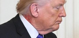 Boynundakı səpkilər müzakirə yaratdı - Foto