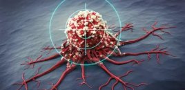 Stressin xərçəngə səbəb olduğu isbat olundu