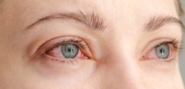 Allergiya mövsümü başladı: Gözlərinizin qorunma yolları