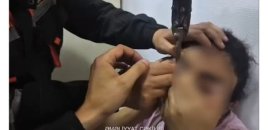 Sabunçuda göz qapağı paltar zəncirbəndinə ilişən qadın xilas edildi - VİDEO