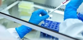 ÜST-dən qorxudan proqnoz: Xərçəng xəstələrinin sayı 35 milyona çata bilər