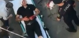 Bakıda arvadını güllələyən kişinin gözü dağılıb - Vəziyyəti ağırdır