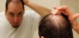 Kişilərin saçı yaş artdıqca niyə tökülür? – Əsas səbəb nədir?