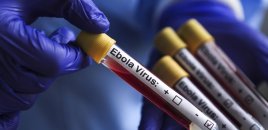 Ebolaya yoluxanların yarısı ölüb - ÜST-dən həyəcan təbili