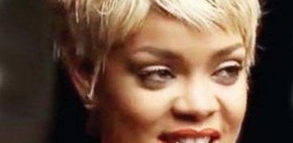 Rihannanın iyrənc dişləri – FOTO