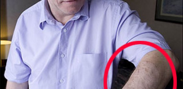 7 il sevgilisindən işgəncə görən kişi - FOTO