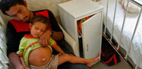 ŞOK! 3 yaşlı oğlan uşağının qarnında körpə tapıldı - FOTO