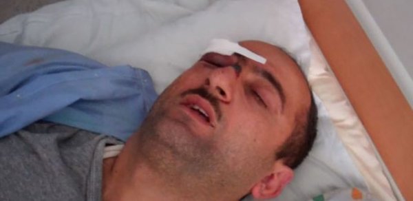 ARDNŞ jurnalisti döyənləri işdən qovacaq