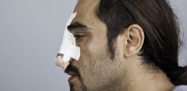 Bakıda gözəllik yarışmasının münsifini küçədə bu hala saldılar - FOTOLAR