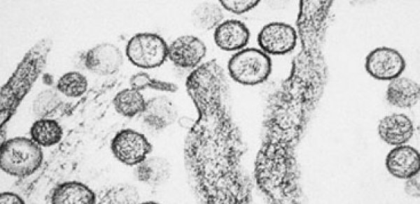 Yeni ölümcül virus yayılır