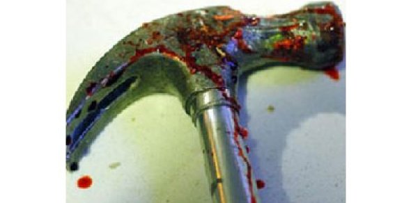 Bakıda ər arvadını çəkiclə döydü