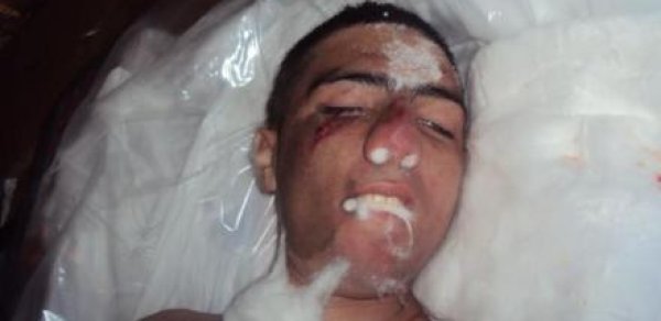 Nazirlikdən əsgərin ölümü ilə bağlı yeni açıqlama - RƏSMİ