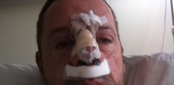 Qadın müğənni ərini döyüb bu günə saldı – FOTOLAR