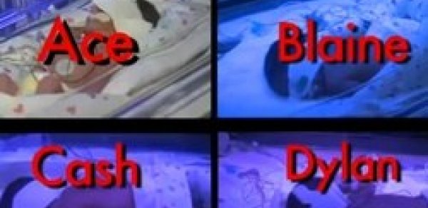 Bir neçə dəqiqəyə 4 uşaq doğdu -  FOTOLAR 