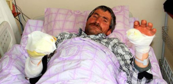 Yerlilərini xilas etmək üçün canavarın qulağını dişlədi