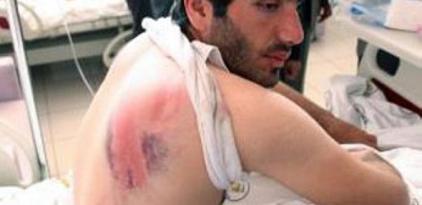 Şagirdlərini qorumaq istəyən müəllimi polislər bu günə saldı – FOTOLAR