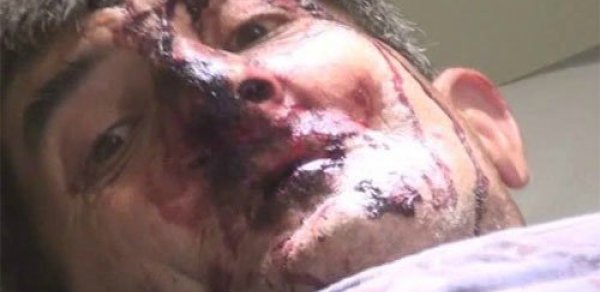 Azərbaycanda ayı insanlara qisas üçün hücum çəkibmiş - TƏFƏRRÜAT