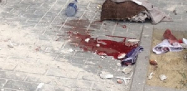 Bakıda gənc oğlanın başı partladı –  ŞOK VİDEO 