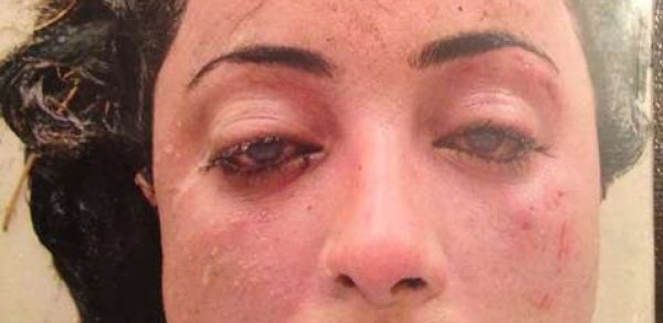 Polis Bakıda tapılan naməlum qadın meyitinin sahibini axtarır - FOTO