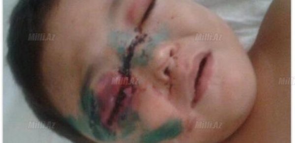 Bakıda balkondan düşən 1 yaşlı körpəni zibil qabı xilas etdi - FOTO