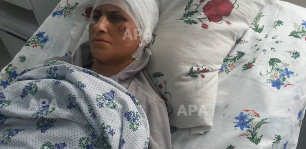 Astarada arvadının qulağını kəsən kişiyə hökm oxundu