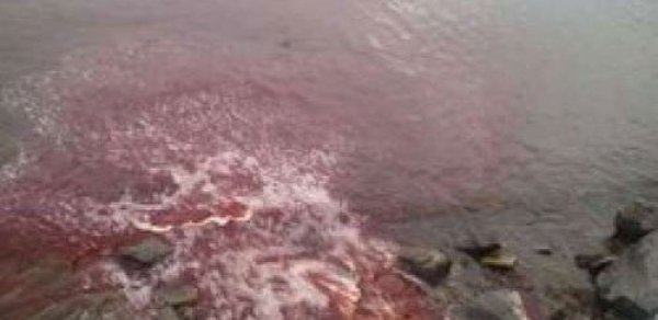 Bakı bulvardakı qan izlərinin sirri açılıdı - - FOTO