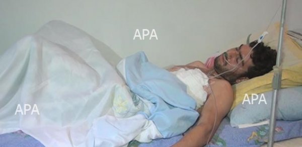 25 yaşlı qadın 23 yaşlı oğlanı bıçaqladı - FOTO