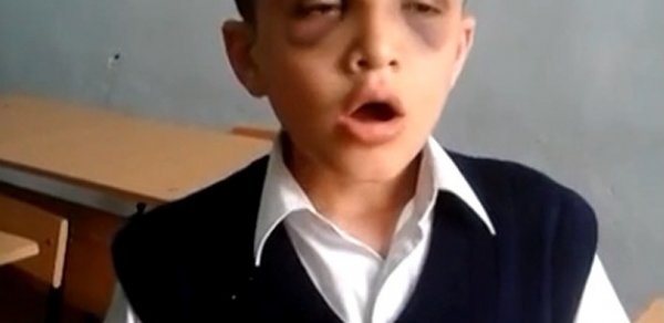 Bakıda müəlliməsi tərəfindən ölümcül döyülən uşaq danışdı -  VİDEO 