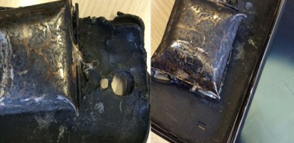 Telefon qulağında partladı -  FOTO 
