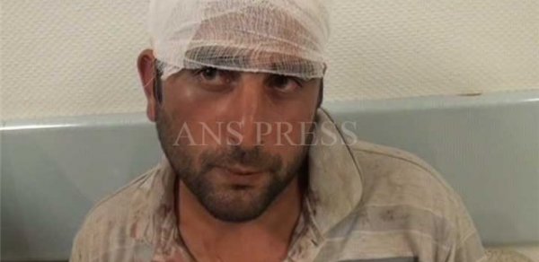 Azərbaycanda mahnı üstündə kütləvi dava - FOTO