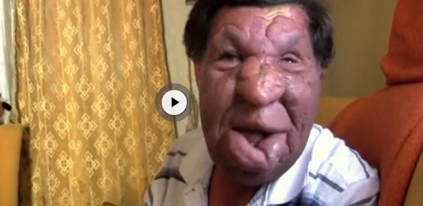 Sosial şəbəkədə bir şəkillə məşhurlaşan üzüxallı adamın ailəsindən -  REPORTAJ 