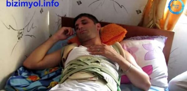 Ramil Usubov beli sındırılan gəncin işini nəzarətə götürdü - VİDEO