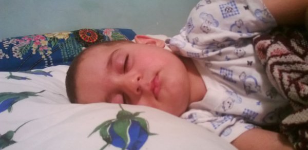 3 yaşlı Fəridin sizlərin köməyinə ehtiyacı var - FOTOLAR