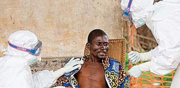 Səhiyyə Nazirliyi Ebola virusu ilə bağlı əmr verdi