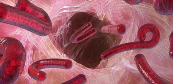 Ebola viruslu tələbələr Azərbaycanda... – AÇIQLAMA