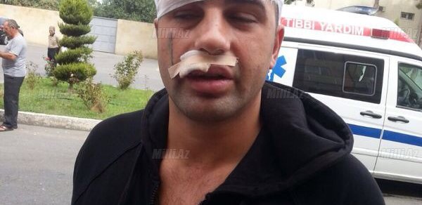 "Rəqs edərkən yaxınlaşıb ki, bura fahişəxanadır?" - "Oazis" qurbanları - FOTO