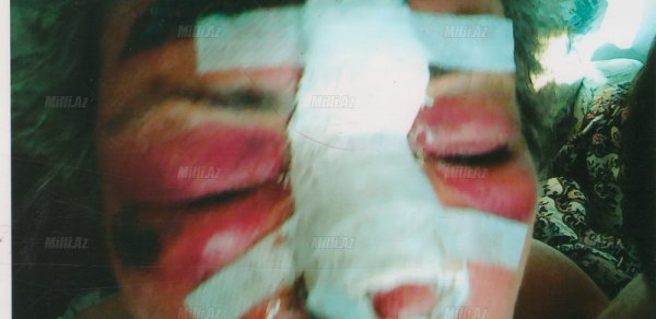 Azərbaycanda 69 yaşlı müəllimənin vəhşicəsinə döyülməsi ilə bağlı – RƏSMİ AÇIQLAMA