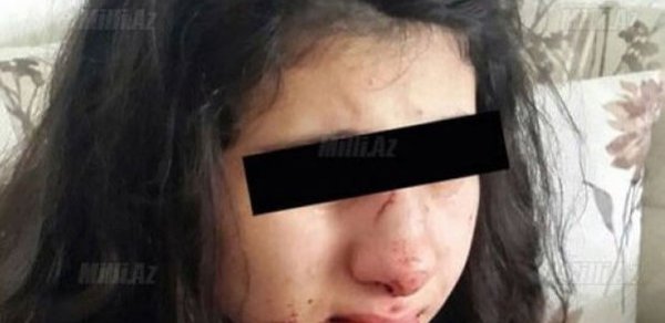Bakıda məktəblini döyən manyak onu zorlamaq istəyib – TƏFƏRRÜAT