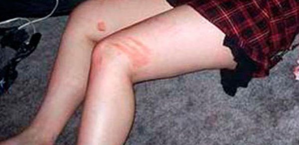 17 oğlan bir qızı zorladı, videoya çəkdi