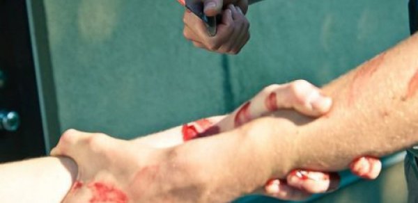 Bakıda oğlu tərəfindən bıçaqlanan ata xəstəxanada öldü
