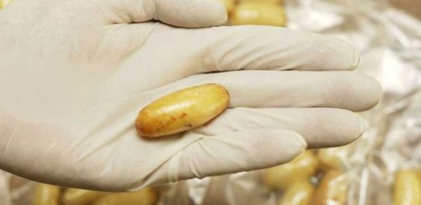 İrandan düz bağırsağında heroin gətirən şəxs saxlanıldı