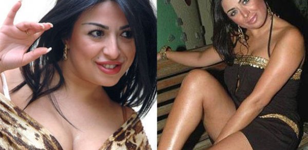 “Pişik” Günel tanınmaz oldu – FOTO