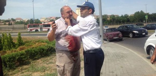 Bakıda dəhşətli qəza: Ata ilə oğul ölümdən döndü - FOTO